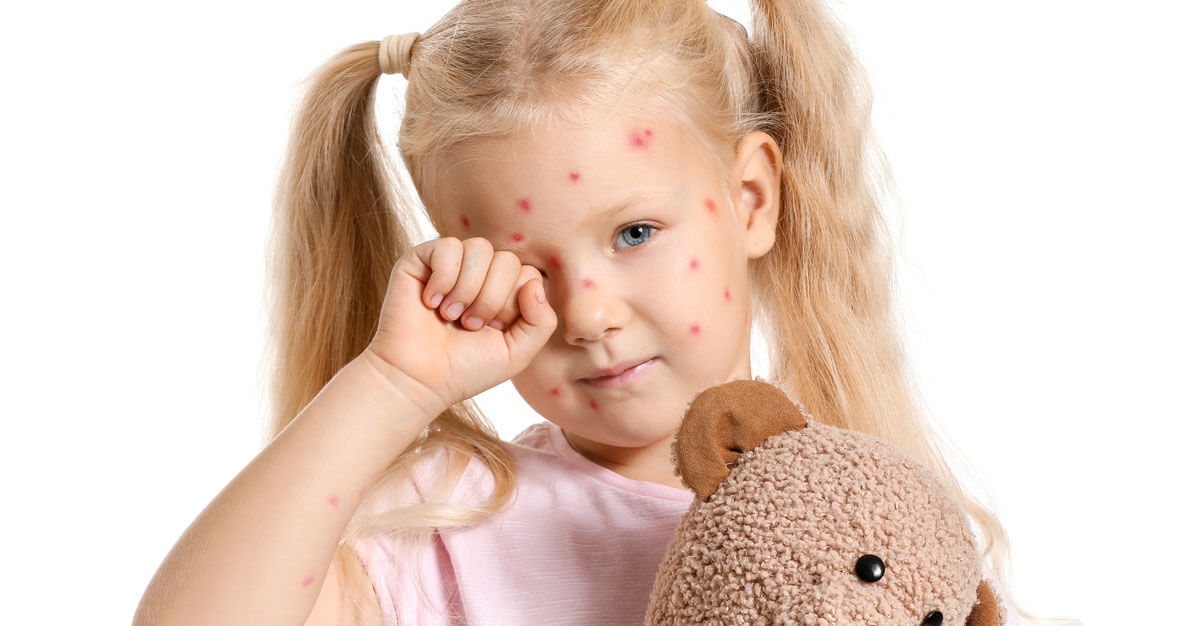 The chickenpox vaccine has helped to save many, and protect millions.